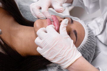 Obraz na płótnie Canvas Lip massage after receiving a botox injection in woman lips. Doctor's hands in white gloves touch the lips, plastic surgery, contour lip surgery, hyaluronic acid.