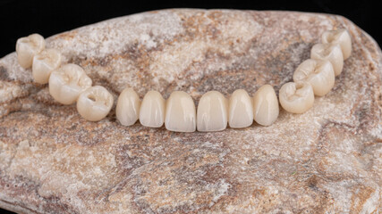 dentures on a black background, dental implants	
