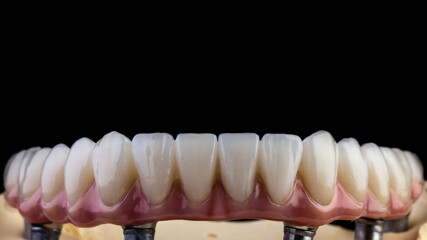 dentures on a black background, dental implants	
