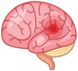 Fototapeta premium The brain has a red signal on white background