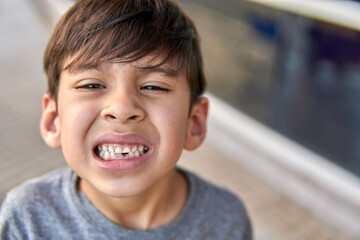 latino toddler drops his first tooth and shows his teeth looking at the camera in pain.Argentinean. blurred background, copy space.