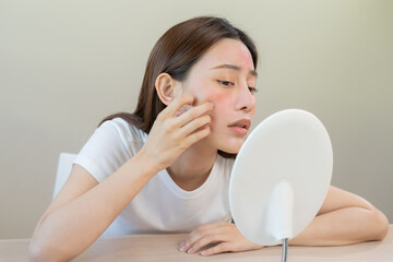 Dermatology, puberty asian young woman, girl looking into mirror, allergy presenting an allergic reaction from cosmetic, red spot or  rash on face. Beauty care from skin problem by medical treatment. - obrazy, fototapety, plakaty