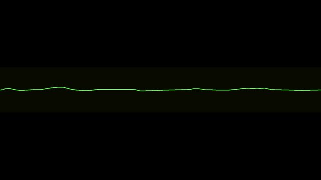 Asystole Images – Browse 2,590 Stock Photos, Vectors, and Video | Adobe  Stock
