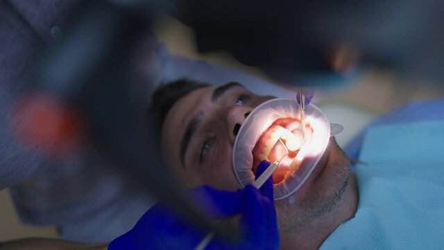 Close-up patient with lip retractor in dentist chair and unrecognizable doctor using dental endodontic binocular microscope examining teeth health. Portrait of Caucasian man consulting expert indoors