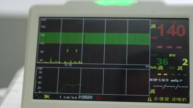 Electronic Cardiotocography Machine Monitoring Fetal Heart Contractions Of Uterus. Printing Cardiogram Report Coming Out Electrocardiogram In Labor Ward During Pregnancy. Medical Diagnostic Equipment