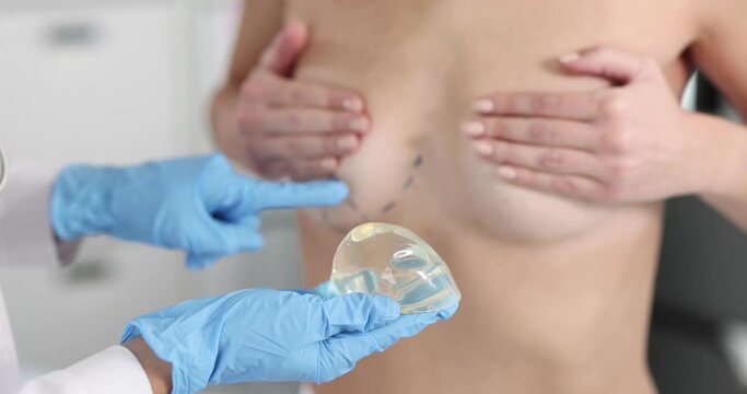 Doctor showing patient with preoperative markings where to inserting breast implant 4k movie slow motion