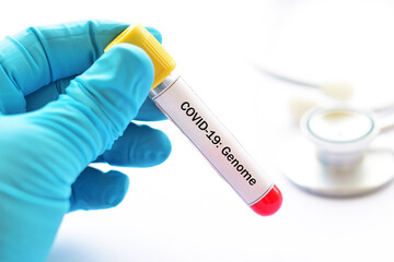 Blood sample tube for COVID-19 genome or variant test