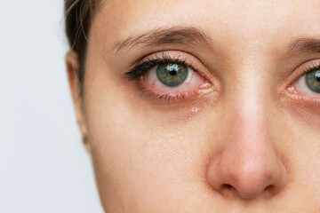 Cropped shot of a young caucasian crying woman with red eyes and nose. Depression, sadness, apathy,...