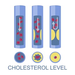 Low, normal, high cholesterol level, vector illustration. High ldl risk factor for heart disease, atherosclerosis.