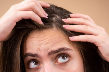 Obraz premium Close up of woman examining her scalp and hair, hair loss on hairline or dry scalp problem.