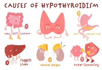Causes of hypothyroidism thyroid gland disease. Endocrine system disorder. Medical vector illustration in cartoon style