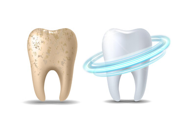 Clean and dirty tooth before and after whitening