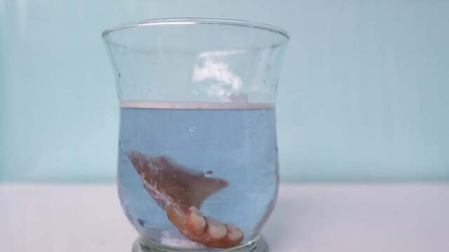 close-up partial plastic prosthesis for the upper jaw of a person in glass, disinfecting soluble effervescent tablet lies in water, air bubbles rise
