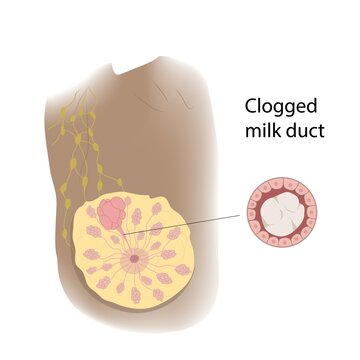 Milk Duct Images Browse 162 Stock Photos Vectors And Video milk-duct-images-browse-162-stock-photos-vectors-and-video
