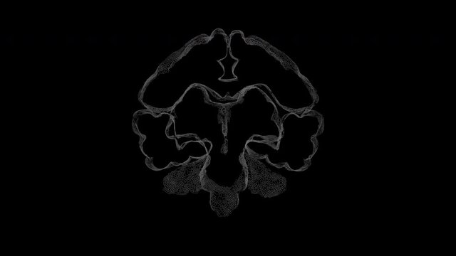 Brain Scan 103: MRI brain imaging diagnostic 3d animation (Loop).