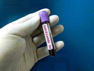 19, africa, alpha, analyze, analyzing, antibody, antigen, atk, b.1.1.529, beta, blood, care,...