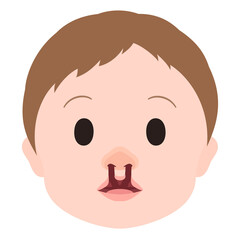 Obraz premium 口唇口蓋裂_両側性唇顎口蓋裂のイラスト_顔