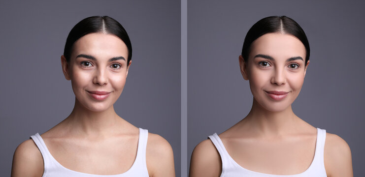 Collage with photos of beautiful young woman before and after using mattifying wipes on grey background. Banner design