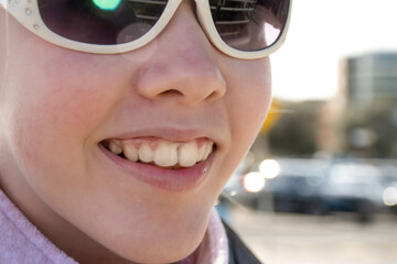 Girl wearing invisible plastic braces. Orthodontic clear removable dental braces teeth straighteners.