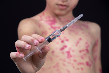 A boy is holding a syringe with a vaccine for the virus in his hand.
