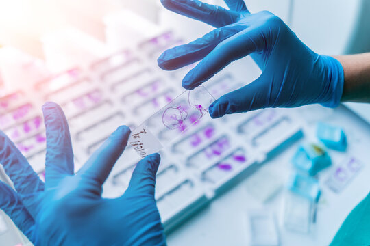 Hand in blue glove holding glass histology slides