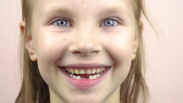 Close-up of the face of a little girl who shows her mouth with fallen milk teeth, grimaces.4k