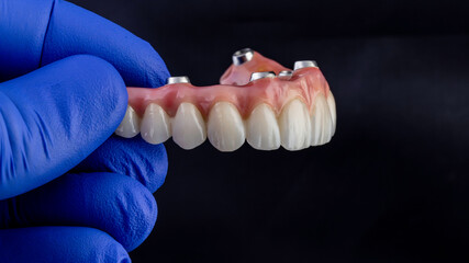 Dental implants and dentures in close-up Siemke on a black background	
