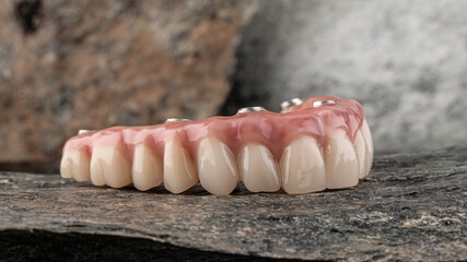 Dental implants and dentures in close-up Siemke on a black background	
