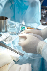 operating tools and chest implants in surgery room