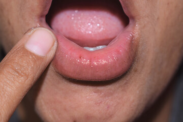 Asian woman applying lip balm closeup