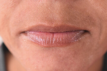 Indian woman lips closeup after applying lip balm on dry lips