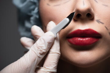 close up of plastic surgeon in latex glove holding scalpel near woman with marked lines on face isolated on grey