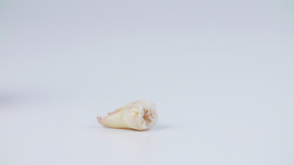 Photo of the removed tooth on white background