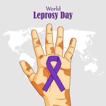 world  leprosy day vector illustration