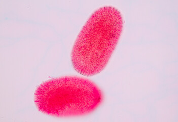 Hydra is a genus of small, fresh-water animals of the phylum Cnidaria and class Hydrozoa under the microscope for education.''