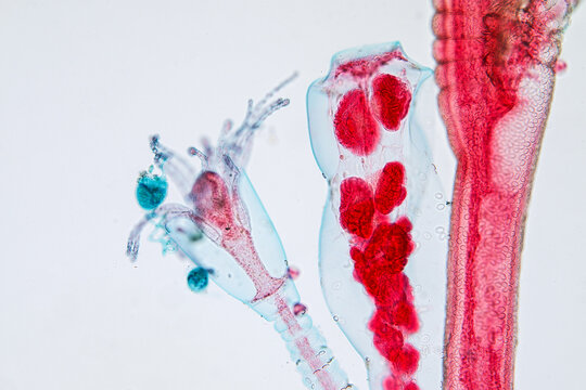 Hydra is a genus of small, fresh-water animals of the phylum Cnidaria and class Hydrozoa under the microscope for education.''