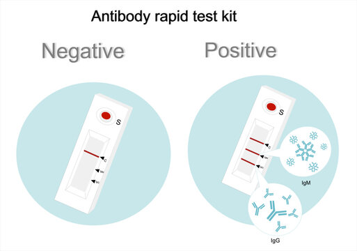 The result of antibody rapid test kit or lateral flow test (immunochromatography technique) that separate interpretation of IgM and IgG.