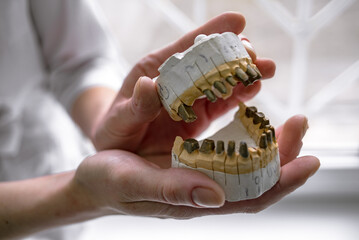Dentistry and prosthetics. The path to beautiful teeth and good health. Dentures in human hands.