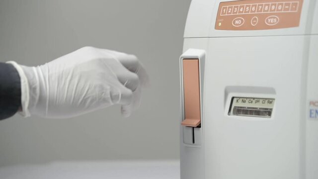 an automated hematology analyzer. close up shot