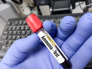 Blood sample tube for Ammonia(NH3) test. To diagnosis blood gas