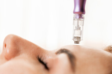 Beauty and skin care. Professional treatment of fractional mesotherapy on client's face. Close up...