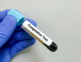 Blood sample for coagulation testing, PT, APTT