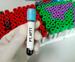 Blood sample for PT, APTT test. coagulation factor testing, diagnosis of bleeding disorder