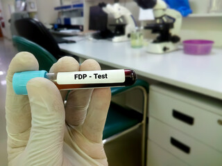 Technician hand blood tube for FDP test. Fibrin degradation product, diagnosis of coagulation...