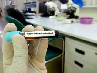 Blood sample for plasma thromboplastin antecedent or factor XI test, diagnosis of coagulation...