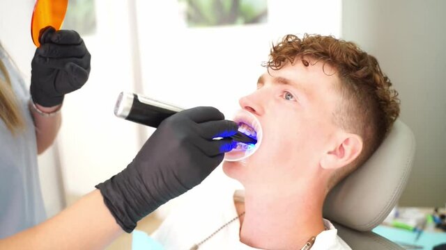 A close-up male patient with optragate on a mouth is having treatment by using curing light for solidification filling on a tooth.