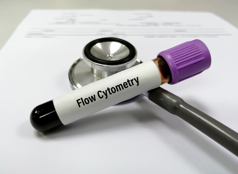 Blood tube with sample for Flow Cytometry test. To detect, identify and count the type of cells in a blood sample. isolated with stethoscope and medical report