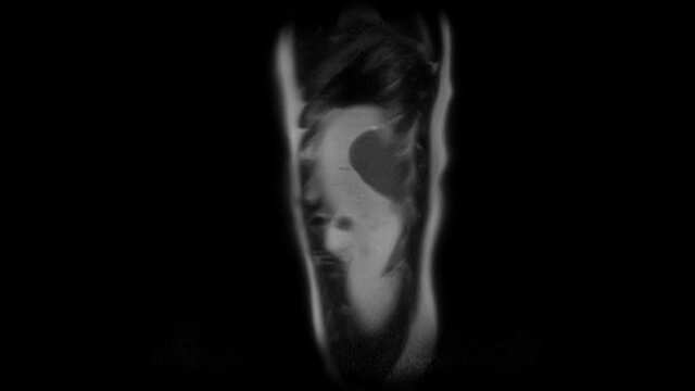 CT scan of the abdomen. Computed tomography of the gastrointestinal tract, liver and kidneys.