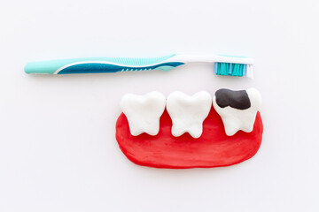 Teeth models with caries or plaque and toothbrush. Oral health concept