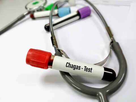 Test Tube with blood sample for Chagas test, American trypanosomiasis. Diagnosis of Chagas disease. A medical testing concept in the laboratory background.